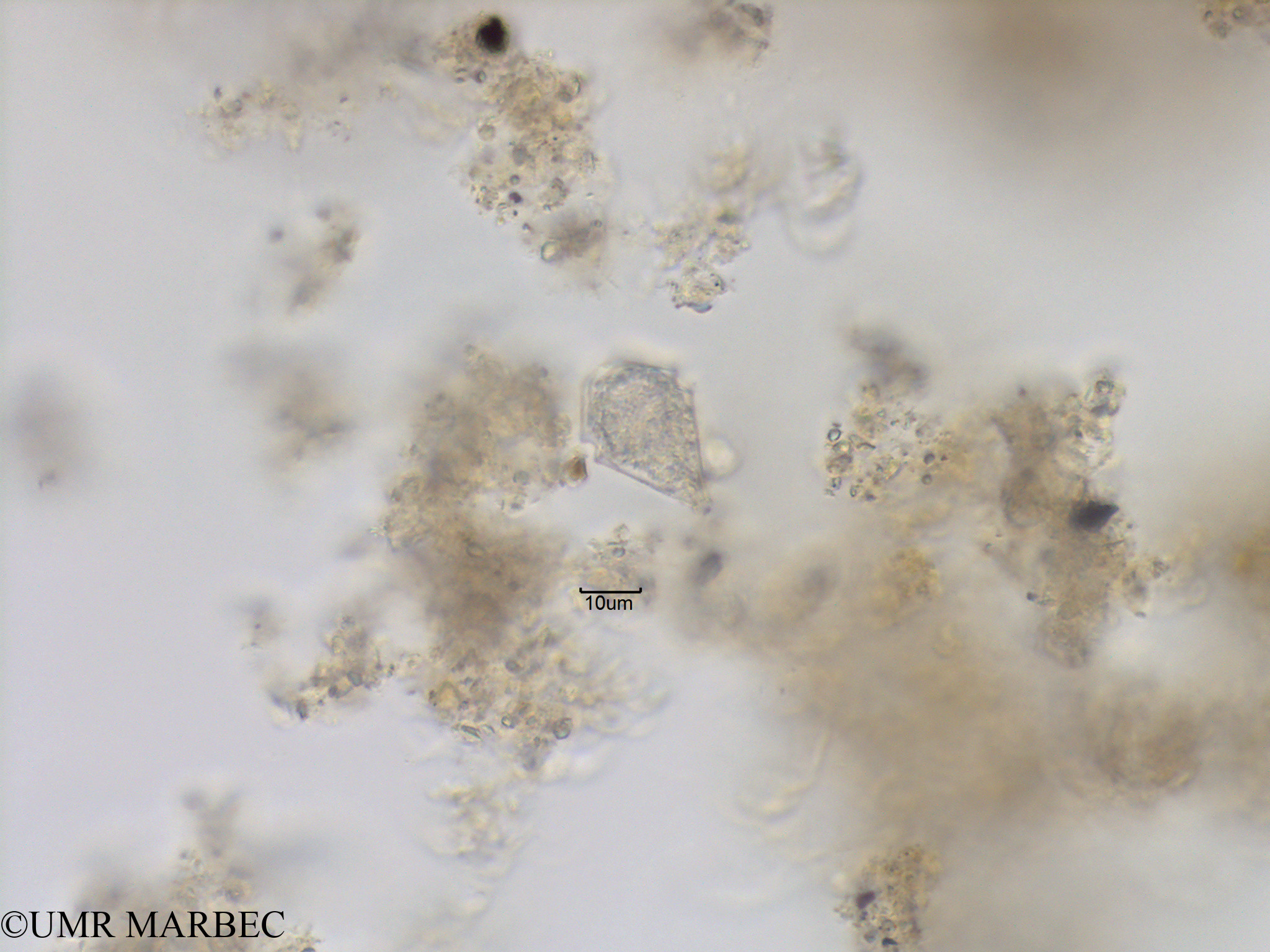 phyto/Bizerte/bizerte_lagoon/RISCO November 2015/Scrippsiella spinifera (Protoperidinium sp15-Lagune_T5_CW3-Proto allongé-8).tif(copy).jpg
